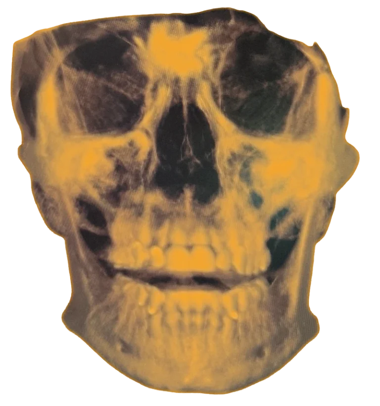 Chris Skull 2